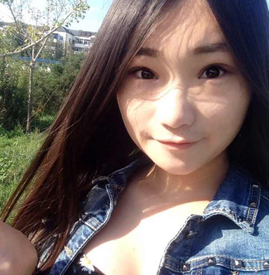 成功得超 声 波双眼 皮手术让wǒ憧憬得美不再shì梦