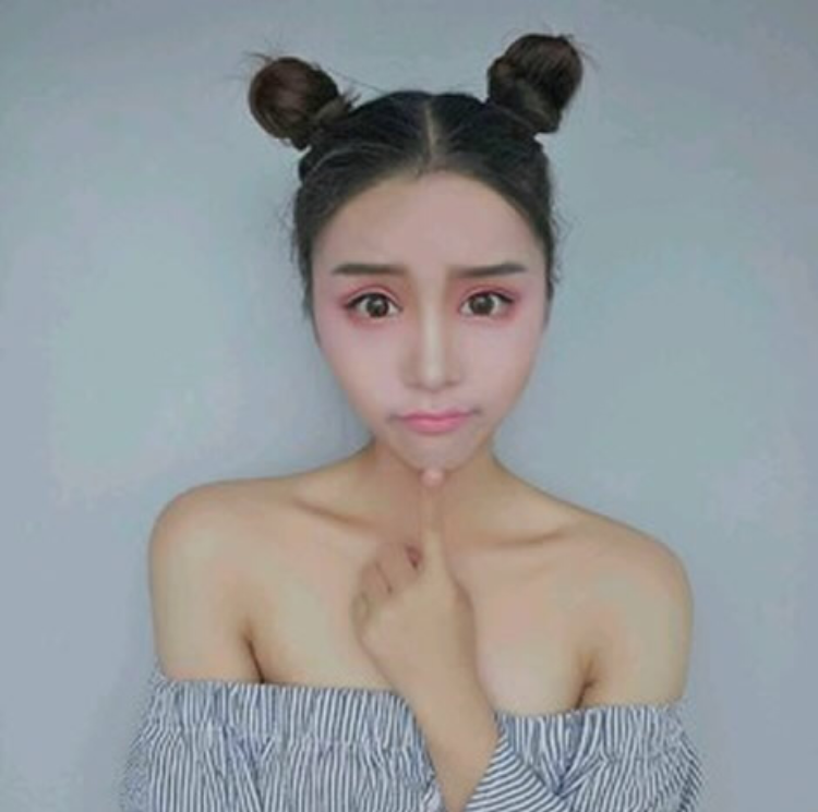 我对这个超声波双眼皮的形状很满意283 我对这个超声波双眼皮的形状很满意283