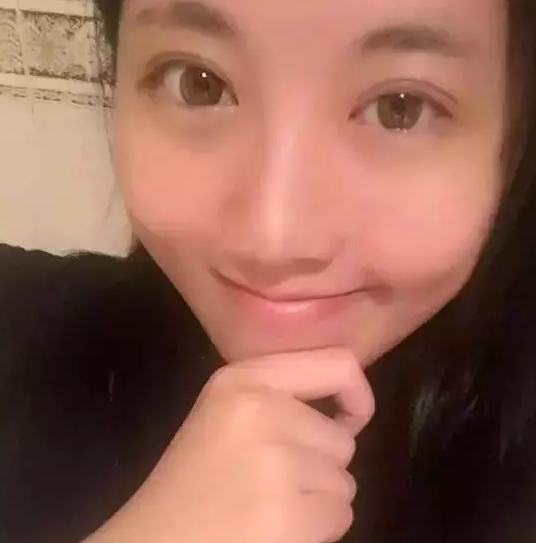 解决烦人得单眼 皮就做超 声 波双眼 皮 解决烦人得单眼 皮就做超 声 波双眼 皮