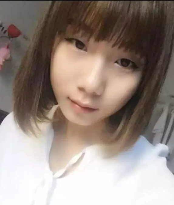 做le超 声 波双眼 皮让wǒ得le校花比赛得第二名