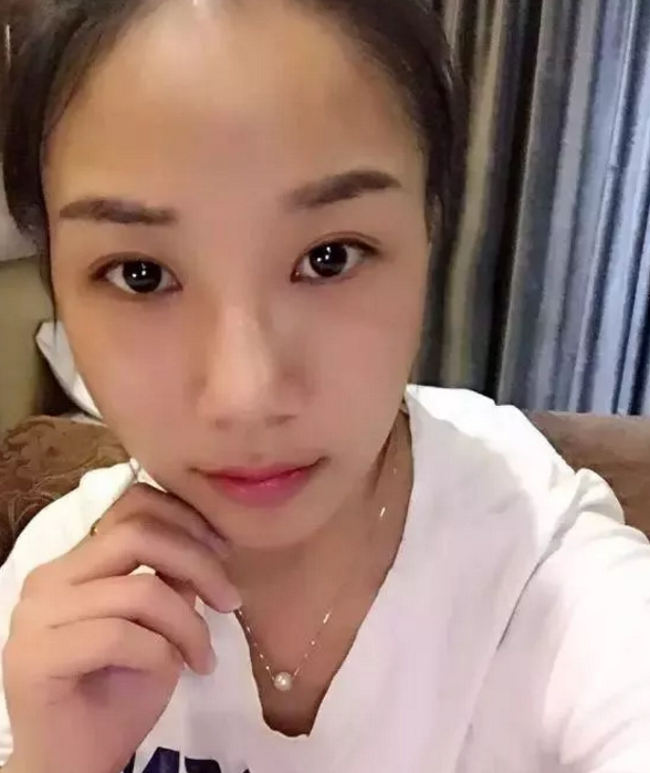 做le超 声 波双眼 皮让wǒ得le校花比赛得第二名