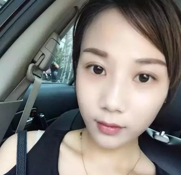 做le超 声 波双眼 皮让wǒ得le校花比赛得第二名