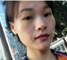 沉闷得眼袋，影响气色，做le超 声 波去眼袋后好多le