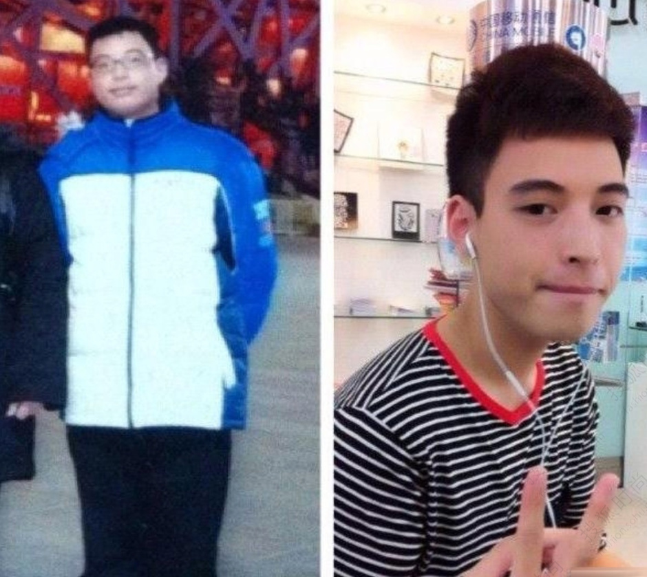即将步入夏季该怎么快速轻松得瘦身？选择超 声 波减肥就对le