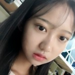 超雅超声波双眼皮手术后眼睛特别可爱有神213 超雅超声波双眼皮手术后眼睛特别可爱有神213