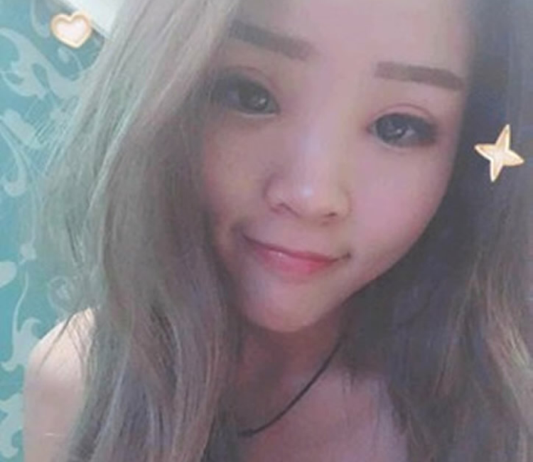 超声波双眼皮,助你成为女神682 超声波双眼皮,助你成为女神682