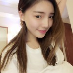 超雅不开刀隆鼻手术以后美丽又自信749 超雅不开刀隆鼻手术以后美丽又自信749