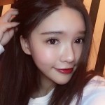 超雅不开刀隆鼻手术以后美丽又自信749 超雅不开刀隆鼻手术以后美丽又自信749