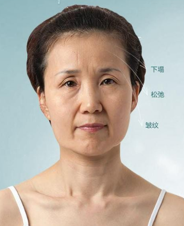 女人想保持年轻可以选择做彭氏童颜术 女人想保持年轻可以选择做彭氏童颜术