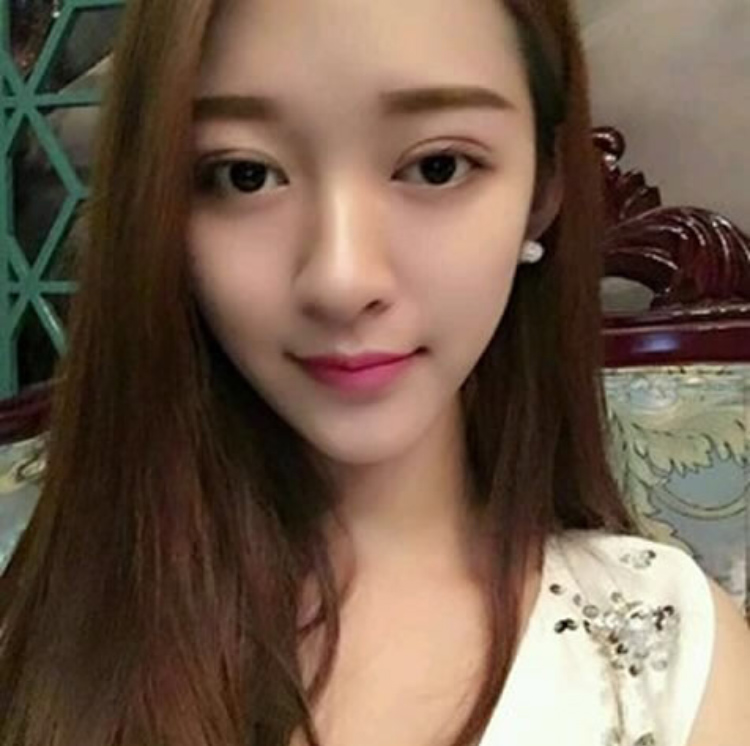 同事分享给我的美容方法——超声波双眼皮461 同事分享给我的美容方法——超声波双眼皮461