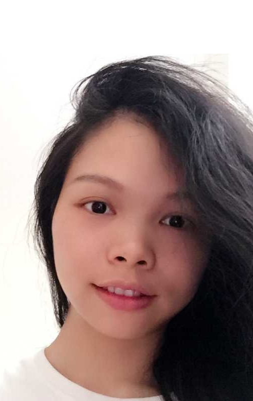 我最终做了超声波去眼袋让我眼袋消除了771 我最终做了超声波去眼袋让我眼袋消除了771