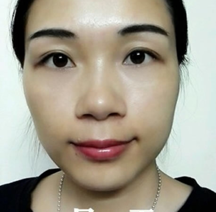 点击查看原图