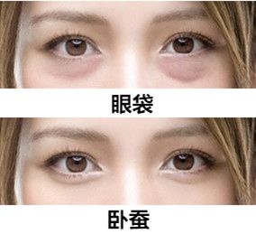 去眼袋可以不需开刀——超声波去眼袋769 去眼袋可以不需开刀——超声波去眼袋769