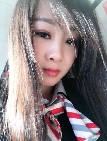 分享我做超声波双眼皮让内双变外双的经验278 分享我做超声波双眼皮让内双变外双的经验278