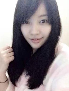 为了更加的精致美丽我做了超声波双眼皮684 为了更加的精致美丽我做了超声波双眼皮684