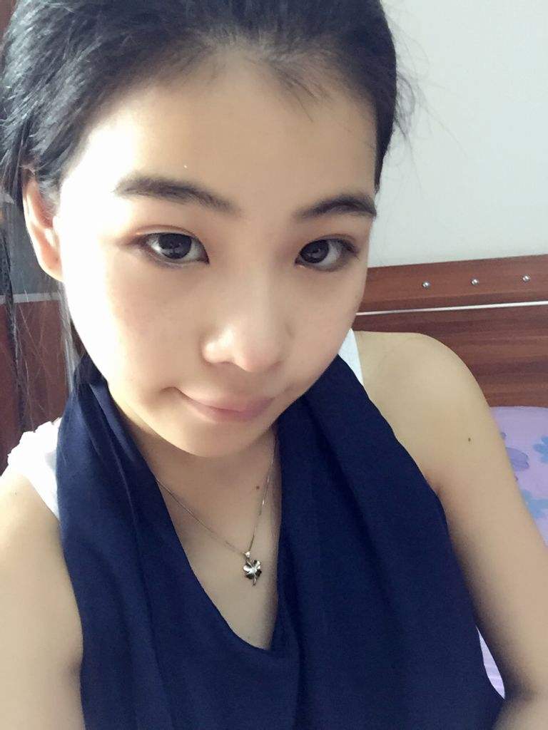 超声波双眼皮手术好不好呢？540