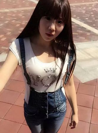 自体脂肪丰胸手术常见问题解析661 自体脂肪丰胸手术常见问题解析661