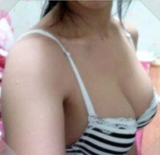 来看看自体脂肪丰胸手术相关问题解析 来看看自体脂肪丰胸手术相关问题解析