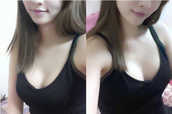 来看看自体脂肪丰胸手术相关问题解析 来看看自体脂肪丰胸手术相关问题解析