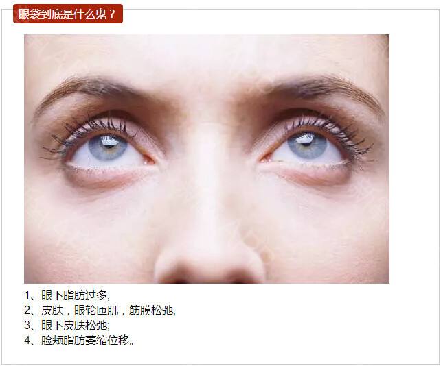 拒绝显老眼袋——超 声 波去眼袋 拒绝显老眼袋——超 声 波去眼袋
