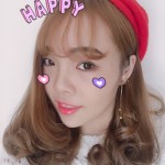 超声波双眼皮手术轻松变漂亮773 超声波双眼皮手术轻松变漂亮773
