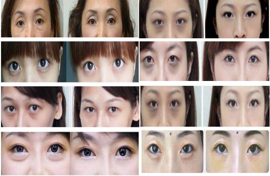 点击查看原图