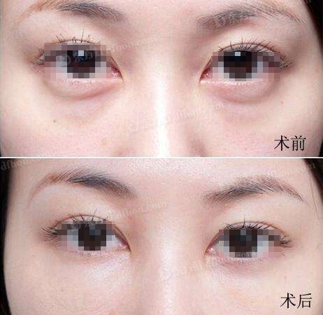 点击查看原图