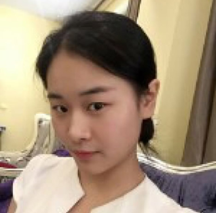 男友对我棒棒哒,直接给卡让我做超声波双眼皮833 男友对我棒棒哒,直接给卡让我做超声波双眼皮833