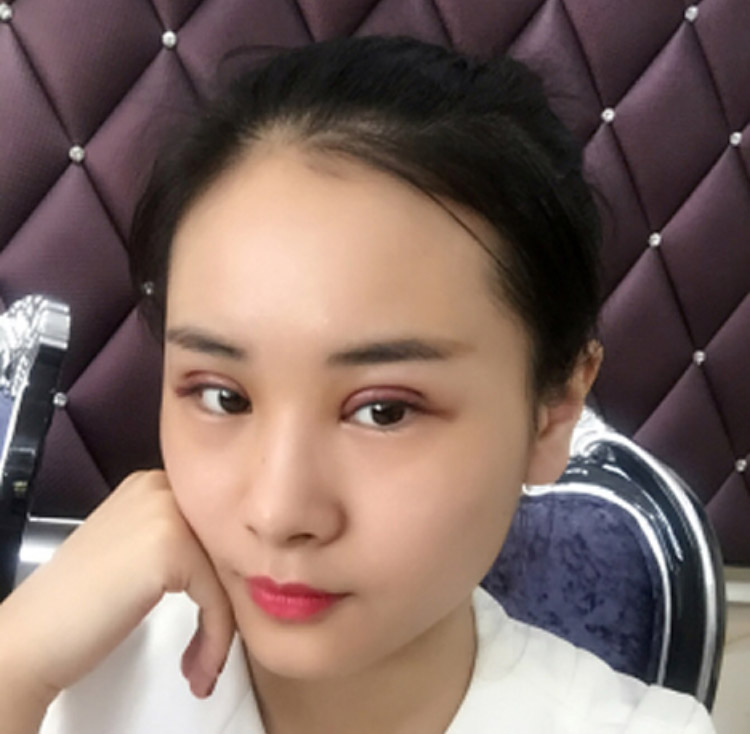 男友对我棒棒哒,直接给卡让我做超声波双眼皮833 男友对我棒棒哒,直接给卡让我做超声波双眼皮833