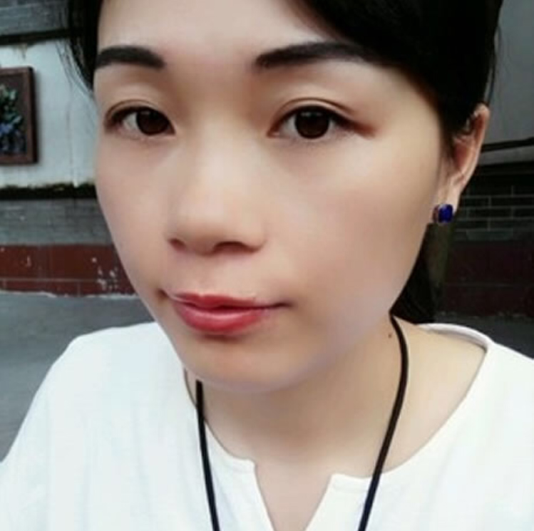 为le未来而拼搏，超 声 波去眼袋帮助wǒ祛除眼袋