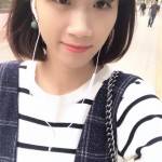 遗传性眼袋也能变身小仙女——超 声 波去眼袋手术 遗传性眼袋也能变身小仙女——超 声 波去眼袋手术