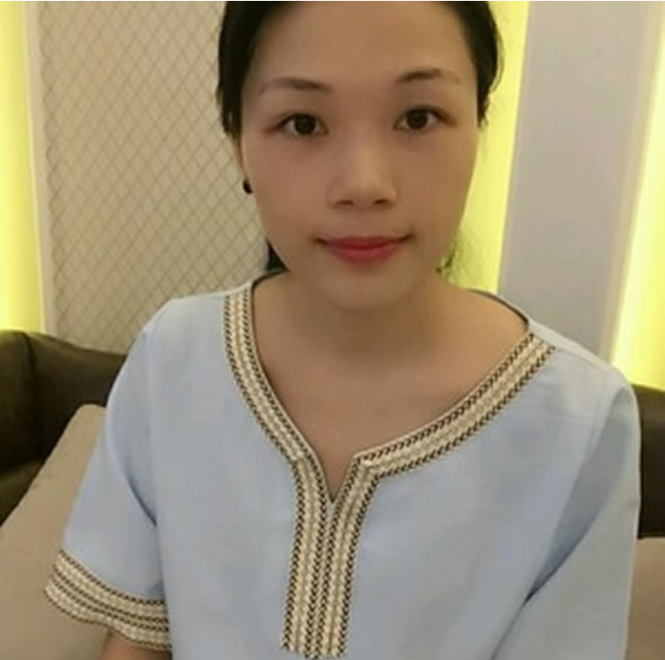 还在等眼袋自然好?那你还不如做超 声 波去眼袋 还在等眼袋自然好?那你还不如做超 声 波去眼袋