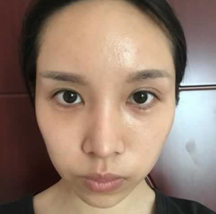 我就是做了超声波瘦脸让我变得更美的727 我就是做了超声波瘦脸让我变得更美的727