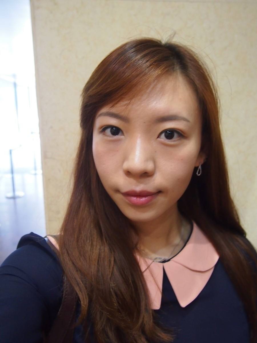 超 声 波双眼 皮能够解决双眼 皮手术失败基本问题