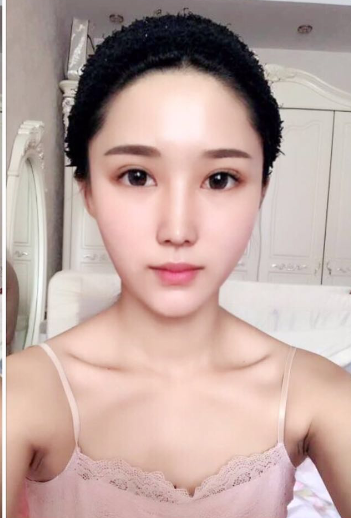 超 声 波去眼袋去le眼袋整个人都精神le 超 声 波去眼袋去le眼袋整个人都精神le
