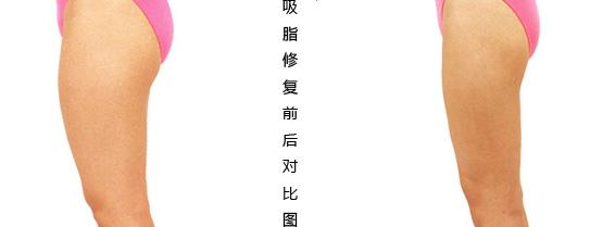 关于超 声 波减肥,你le解吗? 关于超 声 波减肥,你le解吗?