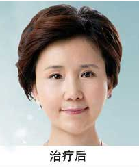 爱漂亮的奶奶做了彭氏童颜术变得年轻漂亮了758 爱漂亮的奶奶做了彭氏童颜术变得年轻漂亮了758