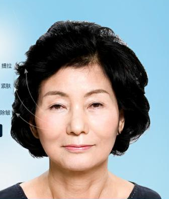 做超 声 波提升术让wǒ再次变年轻 做超 声 波提升术让wǒ再次变年轻