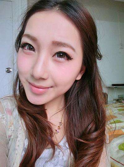 超声波去眼袋手术后多久才能恢复自然状态呢?868 超声波去眼袋手术后多久才能恢复自然状态呢?868