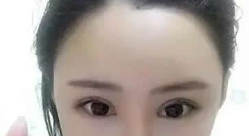 超 声 波双眼 皮让单眼 皮变成双眼 皮 超 声 波双眼 皮让单眼 皮变成双眼 皮