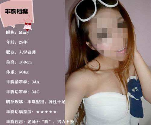 自身、产后导致得乳房问题用何种丰胸手术解决比较好呢？