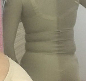 超 声 波减肥瘦掉小肚腩,穿衣不愁! 超 声 波减肥瘦掉小肚腩,穿衣不愁!