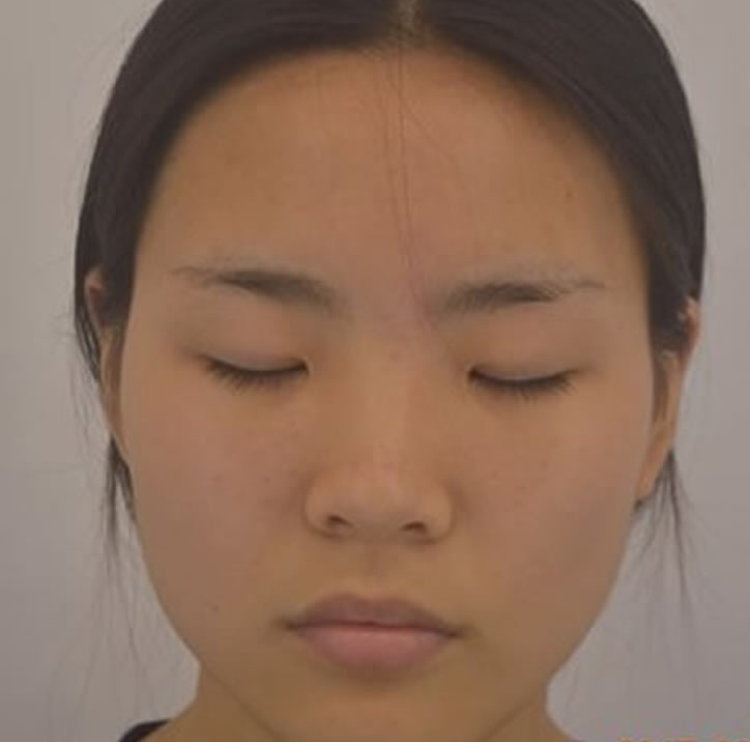 我和我的闺蜜们做超声波双眼皮的故事855 我和我的闺蜜们做超声波双眼皮的故事855