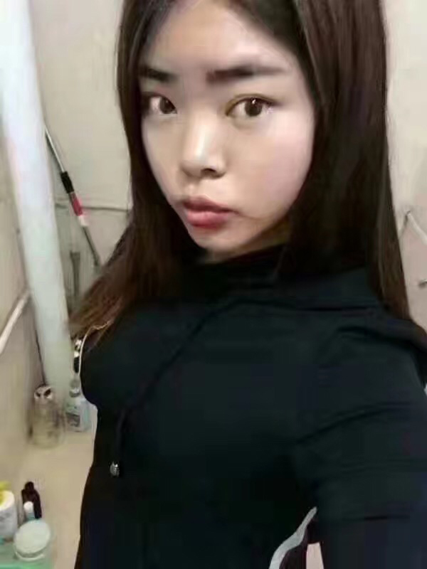重庆超雅的超声波减肥的见解630 重庆超雅的超声波减肥的见解630