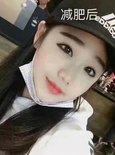 为le追著名演员去做超 声 波减肥 为le追著名演员去做超 声 波减肥