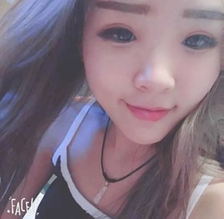 做完超 声 波双眼 皮漂亮le很多 做完超 声 波双眼 皮漂亮le很多