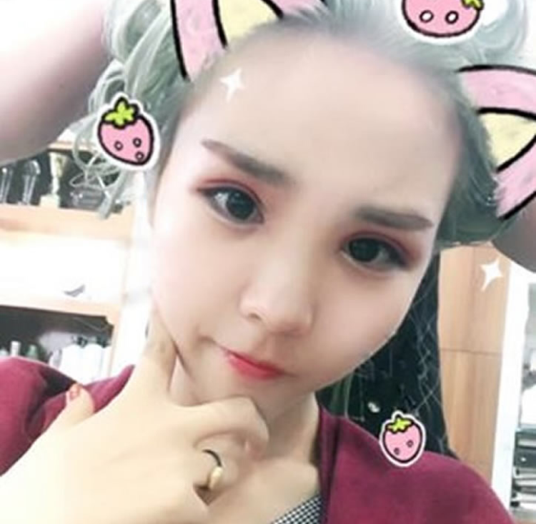 做完超 声 波双眼 皮漂亮le很多 做完超 声 波双眼 皮漂亮le很多