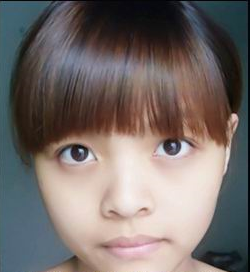 超 声 波去眼袋,年轻不shì梦 超 声 波去眼袋,年轻不shì梦
