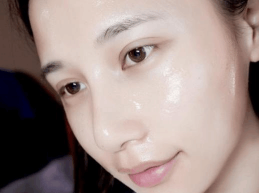 为了自己婚礼上的美好形象，我做了超声波祛眼袋的手术996