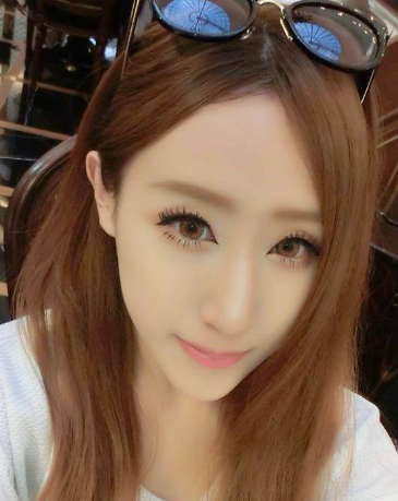 肿泡眼适合做什么类型的双眼皮手术呢?168 肿泡眼适合做什么类型的双眼皮手术呢?168